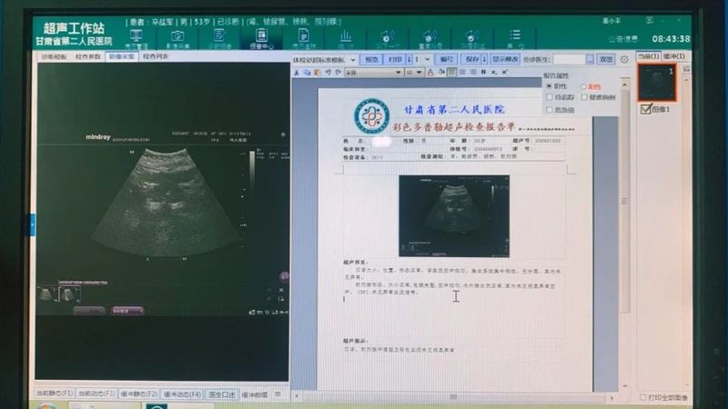 北京体检套餐和单项检查区别到底在哪